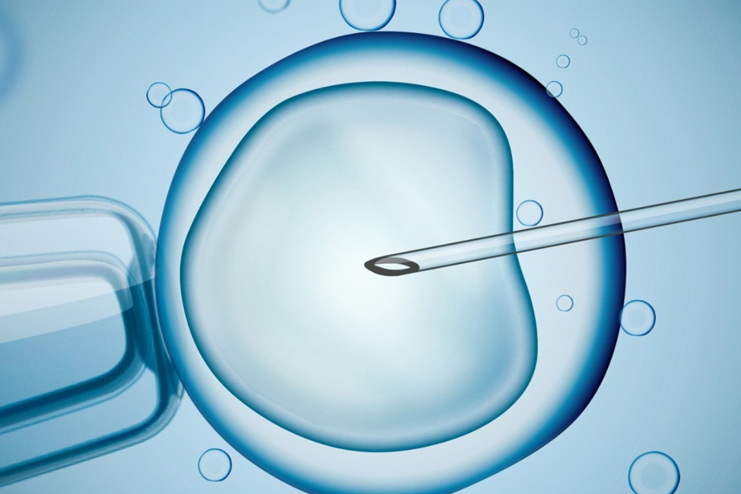 试管婴儿取卵的过程是怎样的？试管婴儿取卵流程步骤